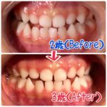 「チューイングブラシ使い方」youtubeアップ