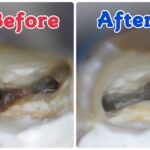 マイクロスコープ精密治療はここまで違う！