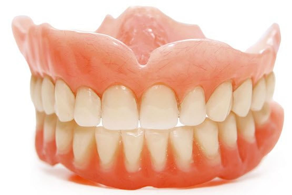 治療用義歯で口腔内環境を正常化